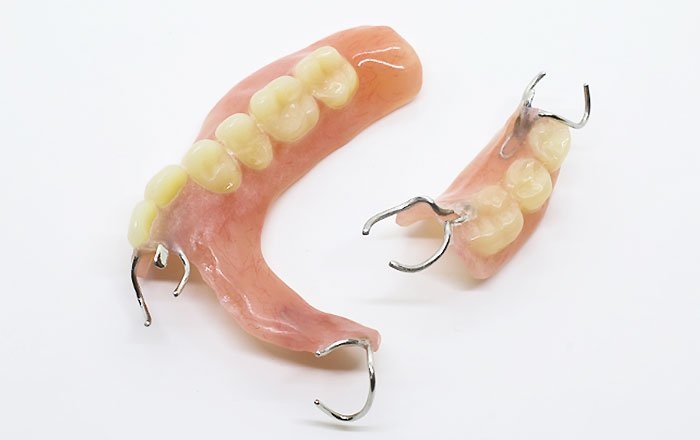 ソケットプリザベーションのメリット：入れ歯の安定感が向上する