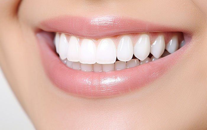 ソケットプリザベーションのメリット：審美性を高く保てる