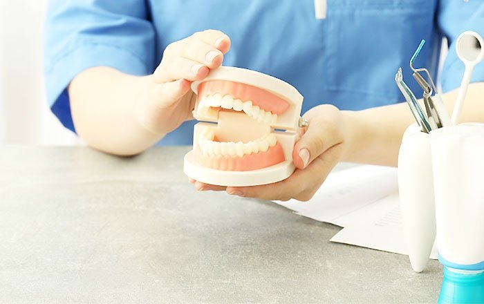 バイオインプラントが注目されるのはなぜ？：噛む力を分散させる