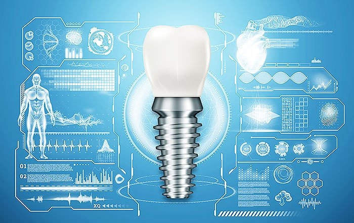 バイオインプラントについて～歯根膜再生を目指す次世代治療の研究と実用化の見通し