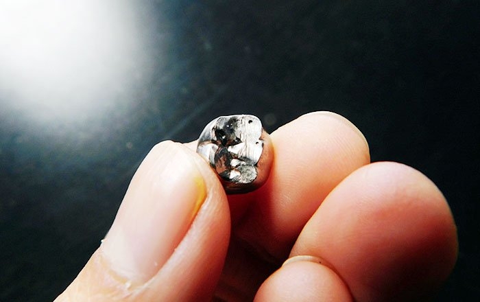 噛み合わせている歯の側にも生じる問題：詰め物や被せ物の脱離や破損