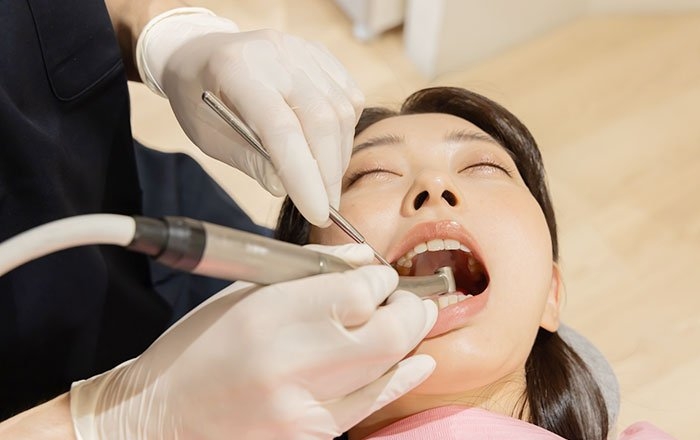 インプラントを長持ちさせるために大切な噛み合わせ調整