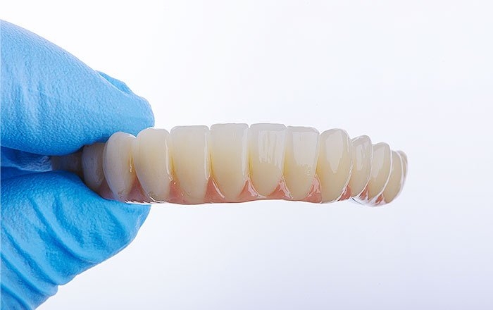 1日で歯が入るインプラント治療（即時荷重インプラント）のメリット：歯がない期間がほぼない