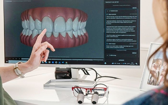 プレシジョンインプラントの特徴