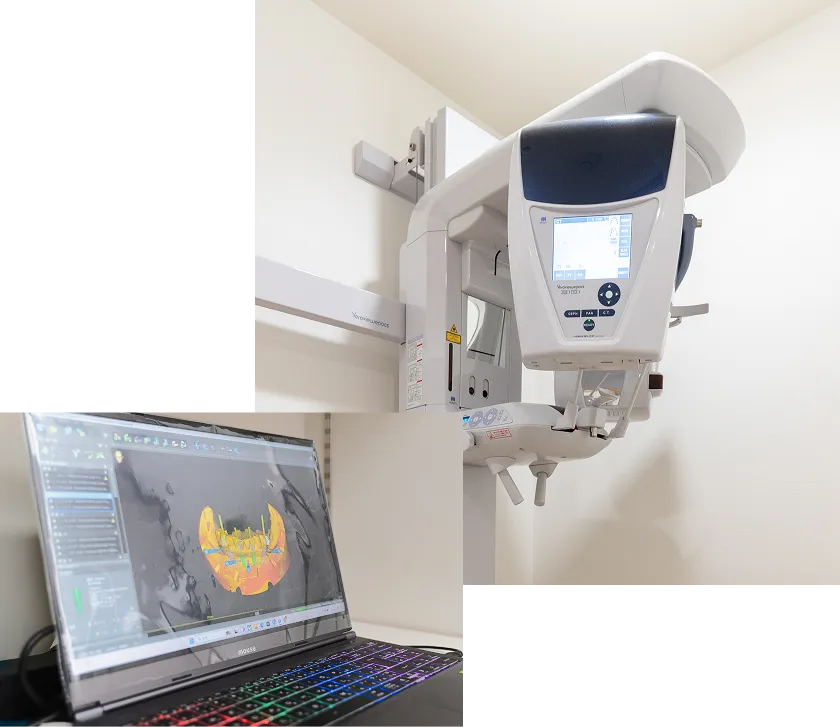 ガイド手術の導入